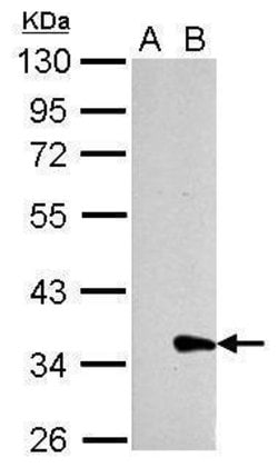 Invitrogen Galectin 8 Polyclonal Antibody 100 μL; Unconjugated:Antibodies,
