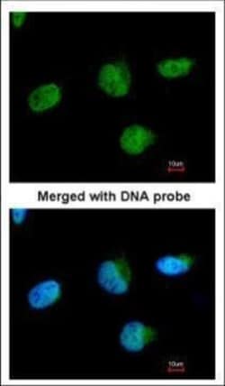 Invitrogen U2AF1 Polyclonal Antibody 100 &mu;L; Unconjugated:Antibodies,