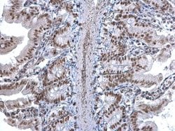 Invitrogen U2AF1 Polyclonal Antibody 100 &mu;L; Unconjugated:Antibodies,