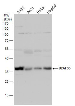 Invitrogen U2AF1 Polyclonal Antibody 100 &mu;L; Unconjugated:Antibodies,