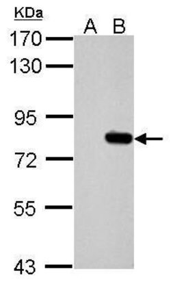Invitrogen SLU7 Polyclonal Antibody 100 &mu;L | Buy Online | Invitrogen&trade; | Fisher Scientific