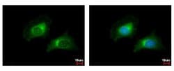 Invitrogen CARD6 Polyclonal Antibody 100 &mu;L; Unconjugated:Antibodies,
