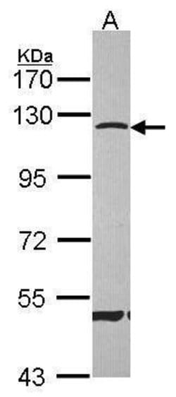 Invitrogen CARD6 Polyclonal Antibody 100 &mu;L; Unconjugated:Antibodies,