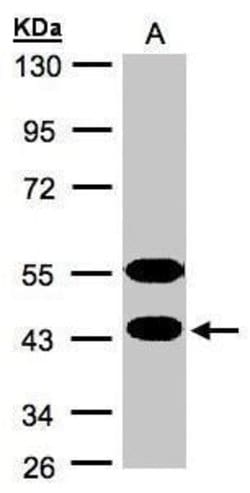Invitrogen CLPH Polyclonal Antibody 100 &mu;L; Unconjugated:Anticuerpos
