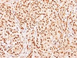 Invitrogen RG9MTD3 Polyclonal Antibody 100 &mu;L | Buy Online | Invitrogen&trade; | Fisher Scientific