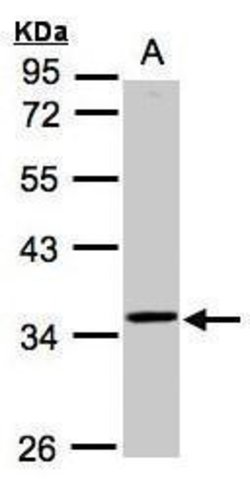 Invitrogen RG9MTD3 Polyclonal Antibody 100 &mu;L | Buy Online | Invitrogen&trade; | Fisher Scientific