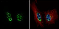 Invitrogen PRP19 Polyclonal Antibody 100 &mu;L; Unconjugated:Antibodies,
