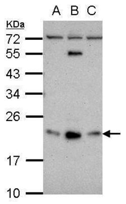 Invitrogen GLIPR1L1 Polyclonal Antibody 100 &mu;L; Unconjugated:Antibodies,