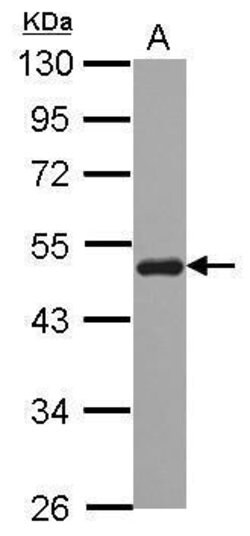 Invitrogen SNX5 Polyclonal Antibody 100 μL; Unconjugated:Antibodies,