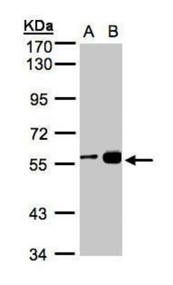 Invitrogen RCC2 Polyclonal Antibody 100 &mu;L; Unconjugated:Antibodies,