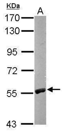 Invitrogen RCC2 Polyclonal Antibody 100 &mu;L; Unconjugated:Antibodies,