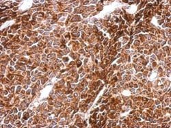 Invitrogen PHF16 Polyclonal Antibody 100 &mu;L | Buy Online | Invitrogen&trade; | Fisher Scientific