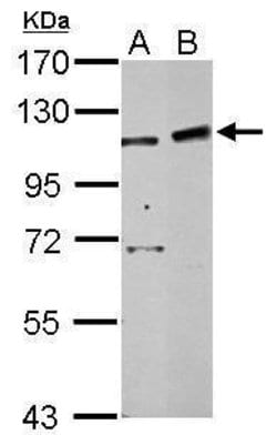 Invitrogen PHF16 Polyclonal Antibody 100 &mu;L | Buy Online | Invitrogen&trade; | Fisher Scientific