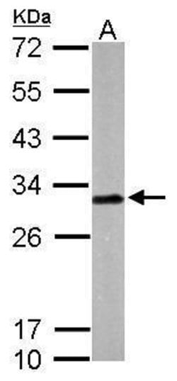 Invitrogen Latexin Polyclonal Antibody 100 μL; Unconjugated:Antibodies,