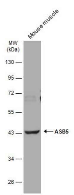 Invitrogen ASB5 Polyclonal Antibody 100 &mu;L; Unconjugated:Antibodies,