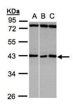 Invitrogen ASB5 Polyclonal Antibody 100 &mu;L; Unconjugated:Antibodies,
