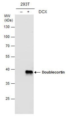 Invitrogen Doublecortin Polyclonal Antibody 100 &mu;L | Buy Online | Invitrogen&trade; | Fisher Scientific