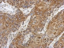 Invitrogen C1orf111 Polyclonal Antibody 100 &mu;L; Unconjugated:Antibodies,