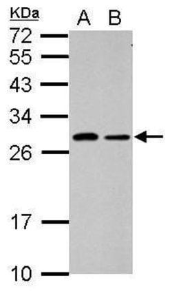 Invitrogen C1orf111 Polyclonal Antibody 100 &mu;L; Unconjugated:Antibodies,