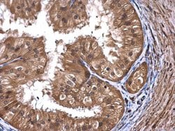Invitrogen ART5 Polyclonal Antibody 100 &mu;L; Unconjugated:Antibodies,