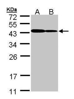 Invitrogen ART5 Polyclonal Antibody 100 &mu;L; Unconjugated:Antibodies,