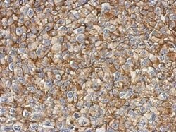 FAM83B Polyclonal Antibody, Invitrogen 100 &mu;L; Unconjugated:Antibodies,