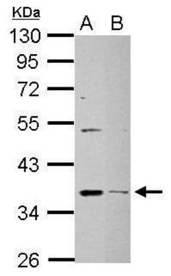 Invitrogen DHRS9 Polyclonal Antibody 100 &mu;L; Unconjugated:Antibodies,
