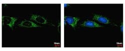 Invitrogen ALDH1B1 Polyclonal Antibody 100 &mu;L; Unconjugated:Antibodies,