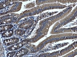 Invitrogen ALDH1B1 Polyclonal Antibody 100 &mu;L; Unconjugated:Antibodies,