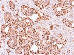 Invitrogen ALDH1B1 Polyclonal Antibody 100 &mu;L; Unconjugated:Antibodies,