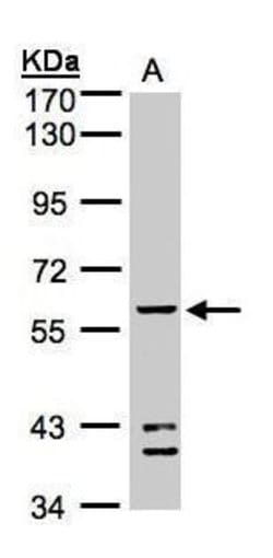 Invitrogen ALDH1B1 Polyclonal Antibody 100 &mu;L; Unconjugated:Antibodies,