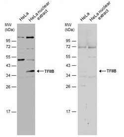 Invitrogen GTF2B Polyclonal Antibody 100 &mu;L; Unconjugated:Antibodies,