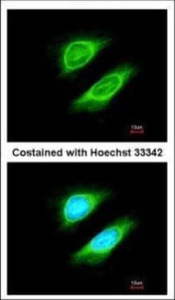 Invitrogen NCAPH Polyclonal Antibody 100 &mu;L; Unconjugated:Anticuerpos