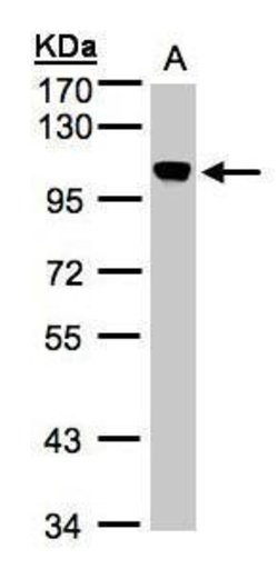 Invitrogen NCAPH Polyclonal Antibody 100 &mu;L; Unconjugated:Anticuerpos