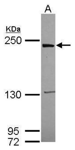Invitrogen LRRK1 Polyclonal Antibody 100 &mu;L | Buy Online | Invitrogen&trade; | Fisher Scientific