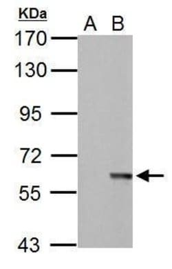 Invitrogen MST2 Polyclonal Antibody 100 &mu;L | Buy Online | Invitrogen&trade; | Fisher Scientific