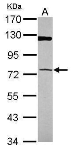 Invitrogen PAPSS1 Polyclonal Antibody 100 &mu;L; Unconjugated:Antibodies,