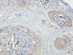 Invitrogen NEK3 Polyclonal Antibody 100 &mu;L; Unconjugated:Antibodies,