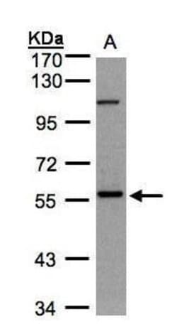 Invitrogen NEK3 Polyclonal Antibody 100 &mu;L; Unconjugated:Antibodies,