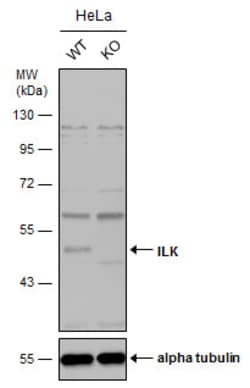 Invitrogen ILK Polyclonal Antibody 100 &mu;L | Buy Online | Invitrogen&trade; | Fisher Scientific