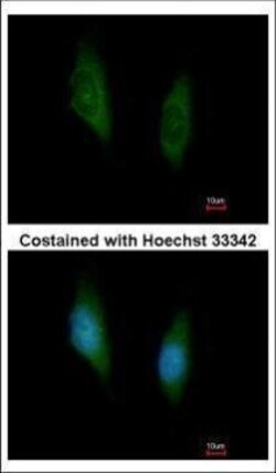 Invitrogen MEK6 Polyclonal Antibody 100 &mu;L | Buy Online | Invitrogen&trade; | Fisher Scientific