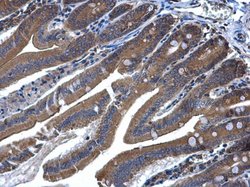 Invitrogen MEK6 Polyclonal Antibody 100 &mu;L; Unconjugated:Antibodies,
