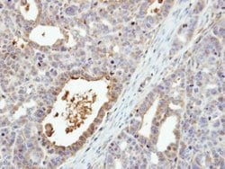 Invitrogen MEK6 Polyclonal Antibody 100 &mu;L; Unconjugated:Antibodies,