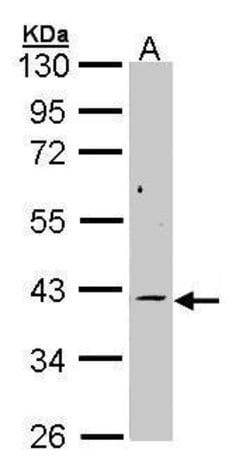 Invitrogen MEK6 Polyclonal Antibody 100 &mu;L; Unconjugated:Antibodies,