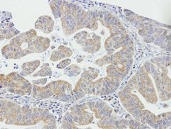 Invitrogen DAPP1 Polyclonal Antibody 100 &mu;L; Unconjugated:Antibodies,