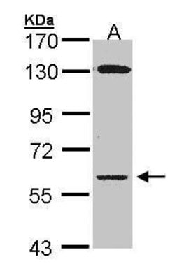 Invitrogen Glycerol kinase Polyclonal Antibody 100 &mu;L | Buy Online | Invitrogen&trade; | Fisher Scientific