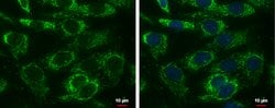 Invitrogen Adenylate Kinase 4 Polyclonal Antibody 100 &mu;L; Unconjugated:Antibodies,