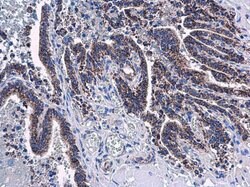 Invitrogen Adenylate Kinase 4 Polyclonal Antibody 100 &mu;L; Unconjugated:Antibodies,