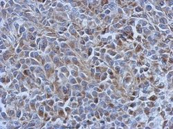 Invitrogen Adenylate Kinase 4 Polyclonal Antibody 100 &mu;L; Unconjugated:Antibodies,