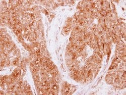 Invitrogen CaMKI gamma Polyclonal Antibody 100 &mu;L; Unconjugated:Antibodies,